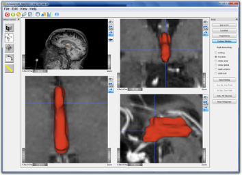 AC-PC Aligned Surface Mesh