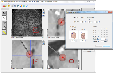 Trajectory Planning (incl. Lead No. 3389)