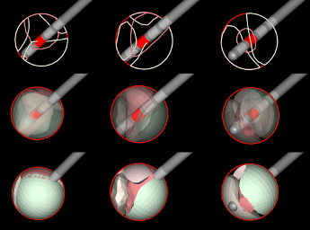 Volumetry of Model / Electrical Field Intersections